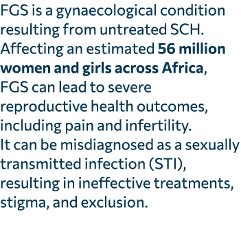 FGS is a gynaecological condition resulting from untreated SCH. Affecting an estimated 56 million women and girls acr...
